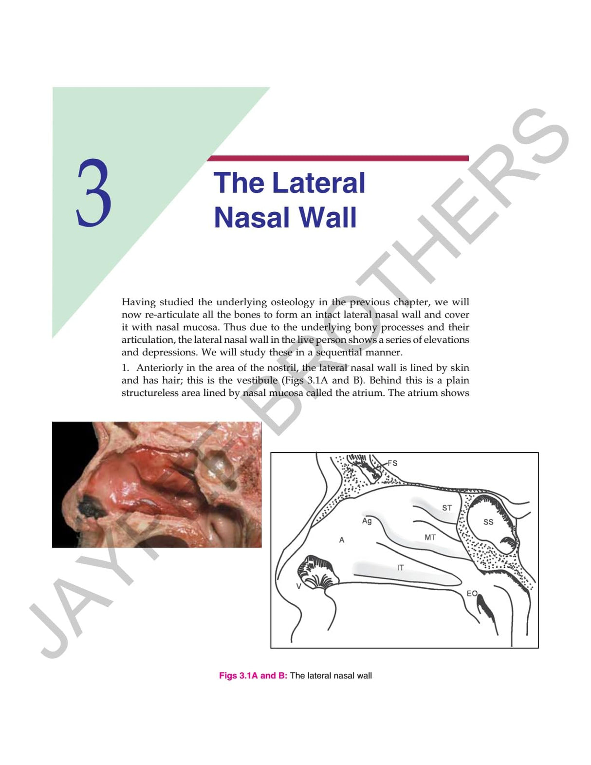 ANATOMICAL PRINCIPLES OF ENDOSCOPIC SINUS SURGERY: A STEP BY STEP APPROACH WITH INTERACTIVE CD-ROM