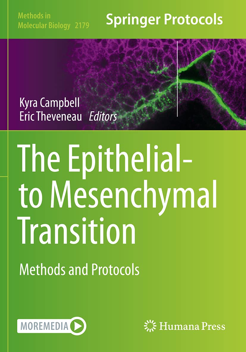The Epithelial-to Mesenchymal Transition: Methods and Protocols: 2179 (Methods in Molecular Biology) - Retail Maharaj