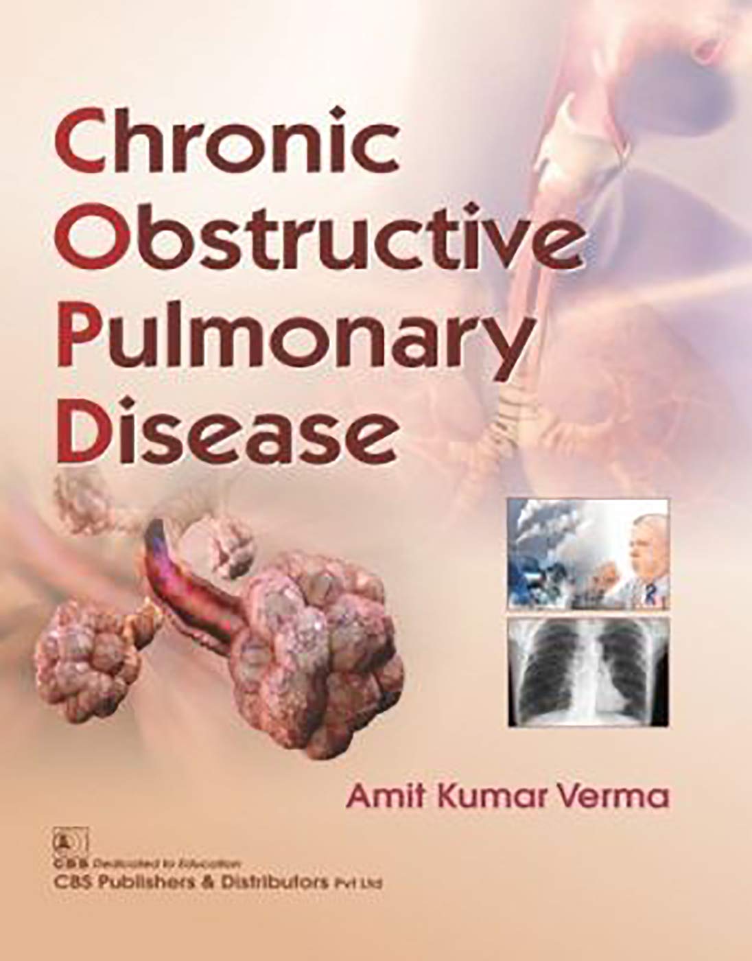 CHRONIC OBSTRUCTIVE PULMONARY DISEASE (PB 2019)