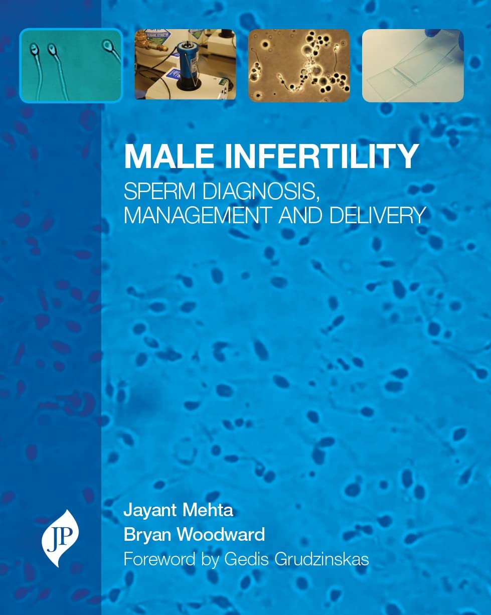 MALE INFERTILITY SPERM DIAGNOSIS MANAGEMENT AND DELIVERY