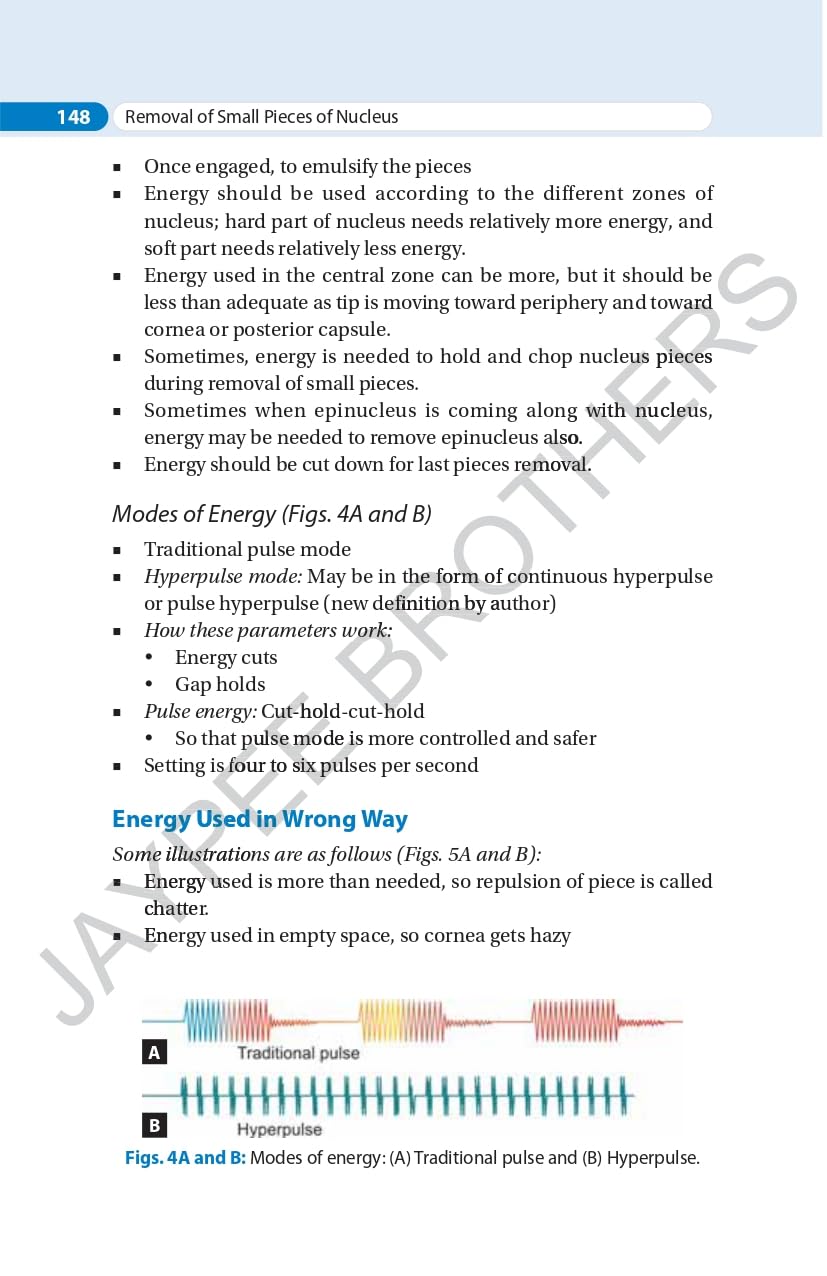 SIMPLIFIED PHACOEMULSIFICATION