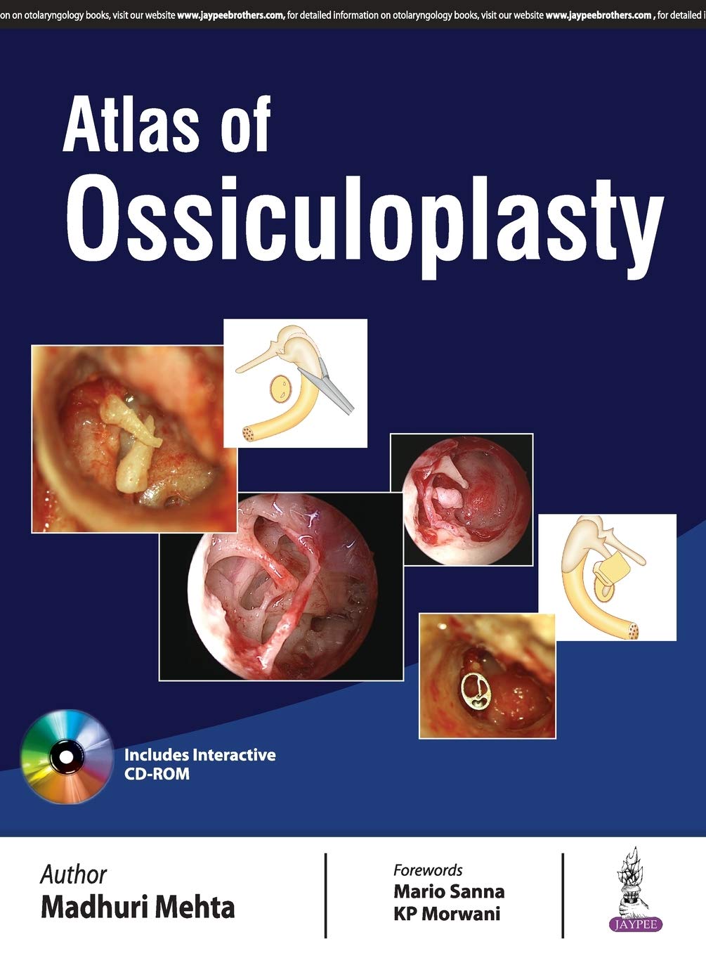 ATLAS OF OSSICULOPLASTY