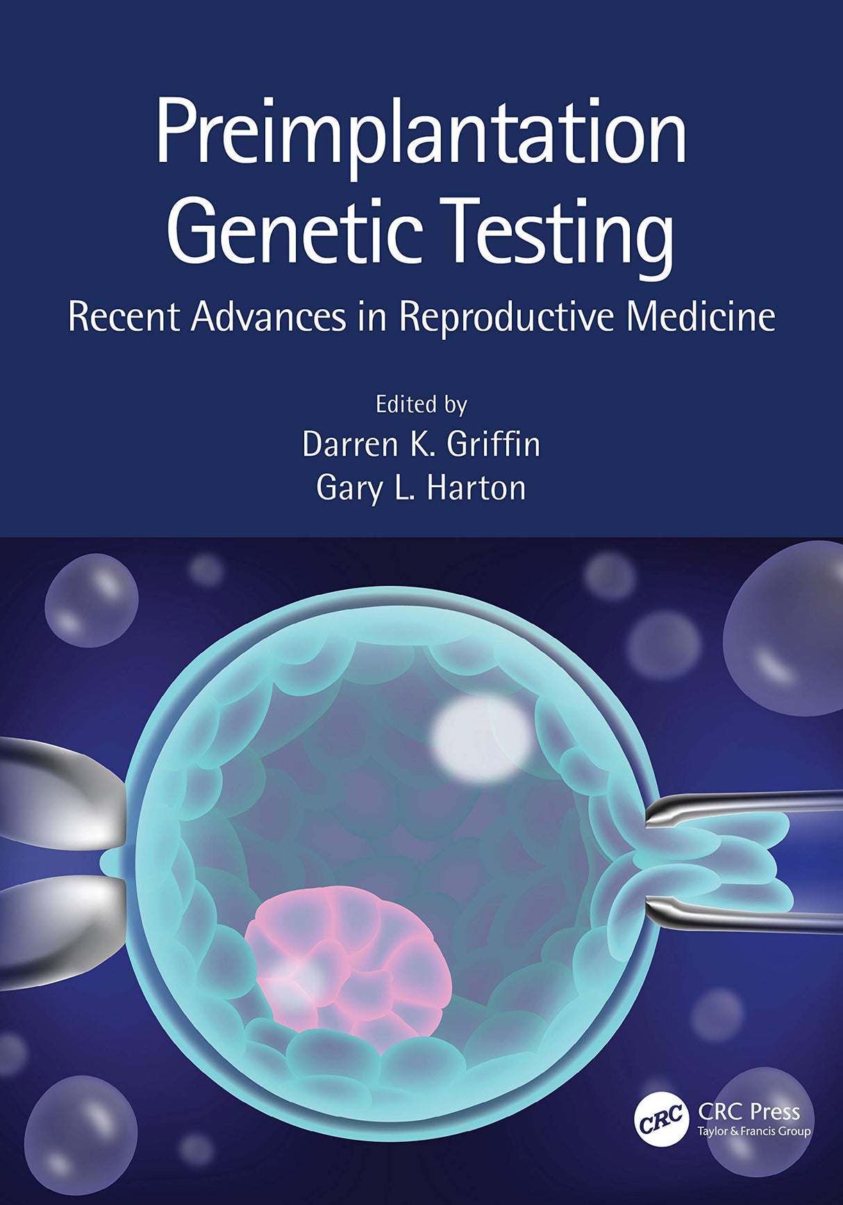 Perimplantation Genetic Testing Recent Advances In Reproductive Medicine (Pb 2020)