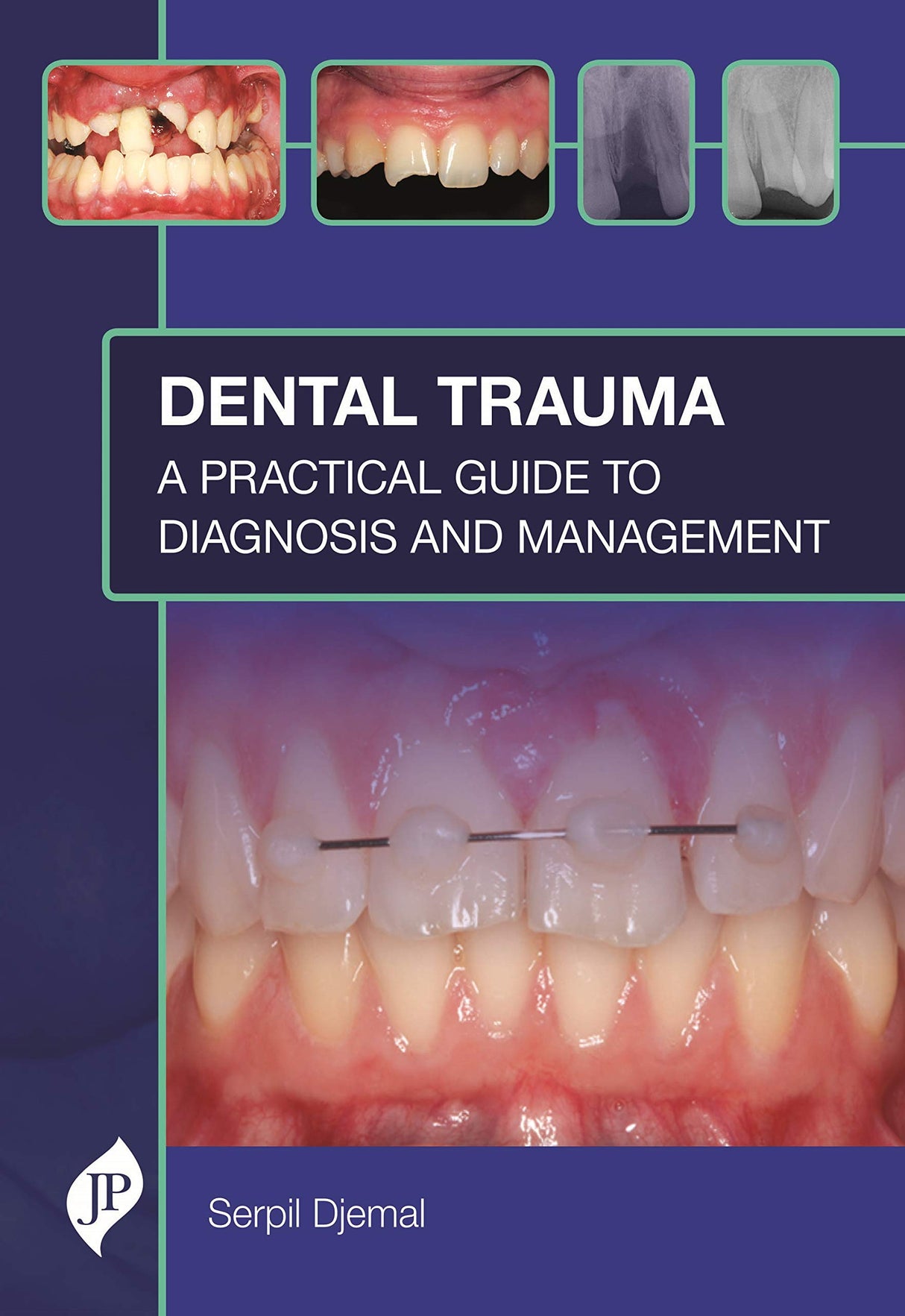 DENTAL TRAUMA: A PRACTICAL GUIDE TO DIAGNOSIS AND MANAGEMENT