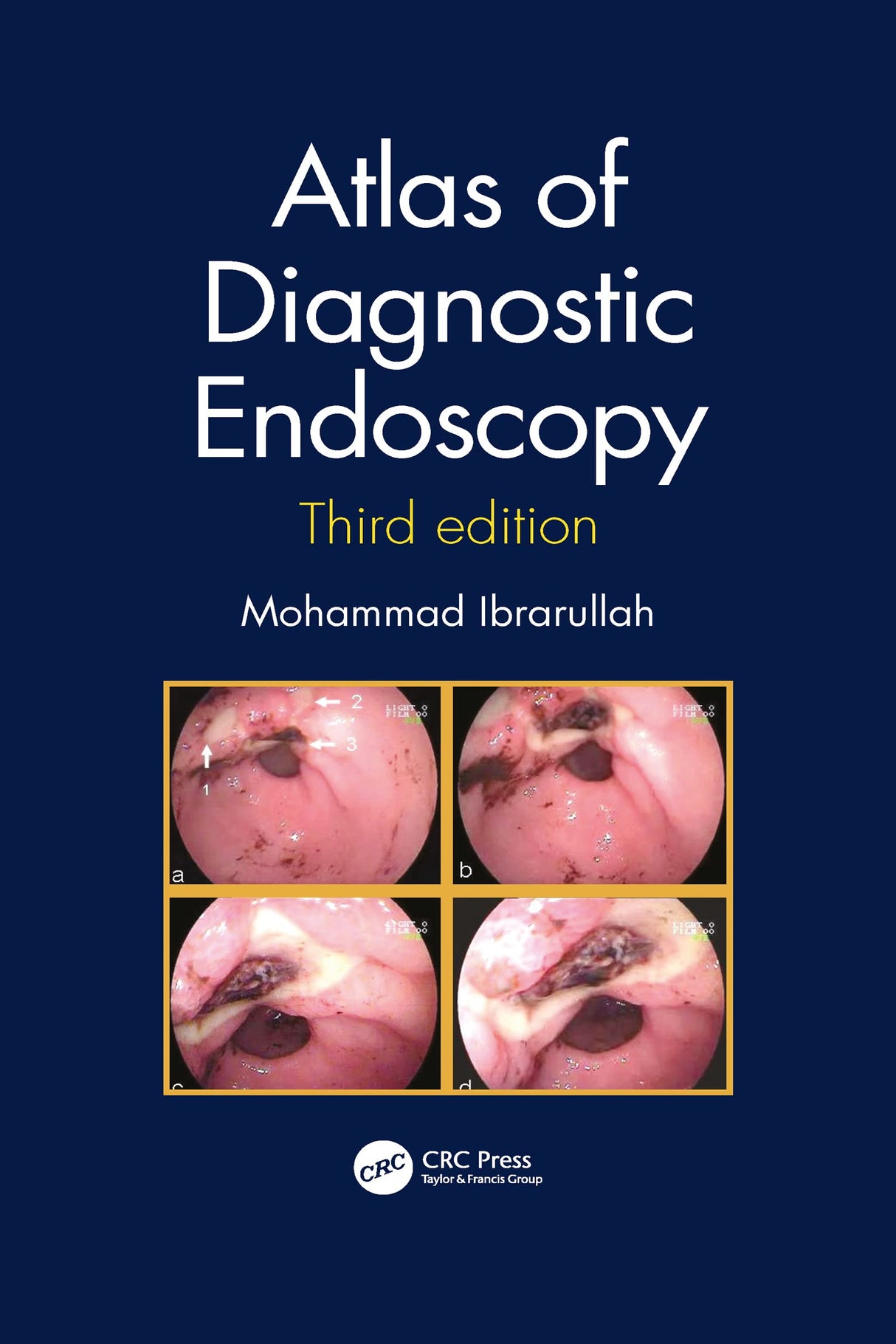 Atlas Of Diagnostic Endoscopy 3Ed (Pb 2021)
