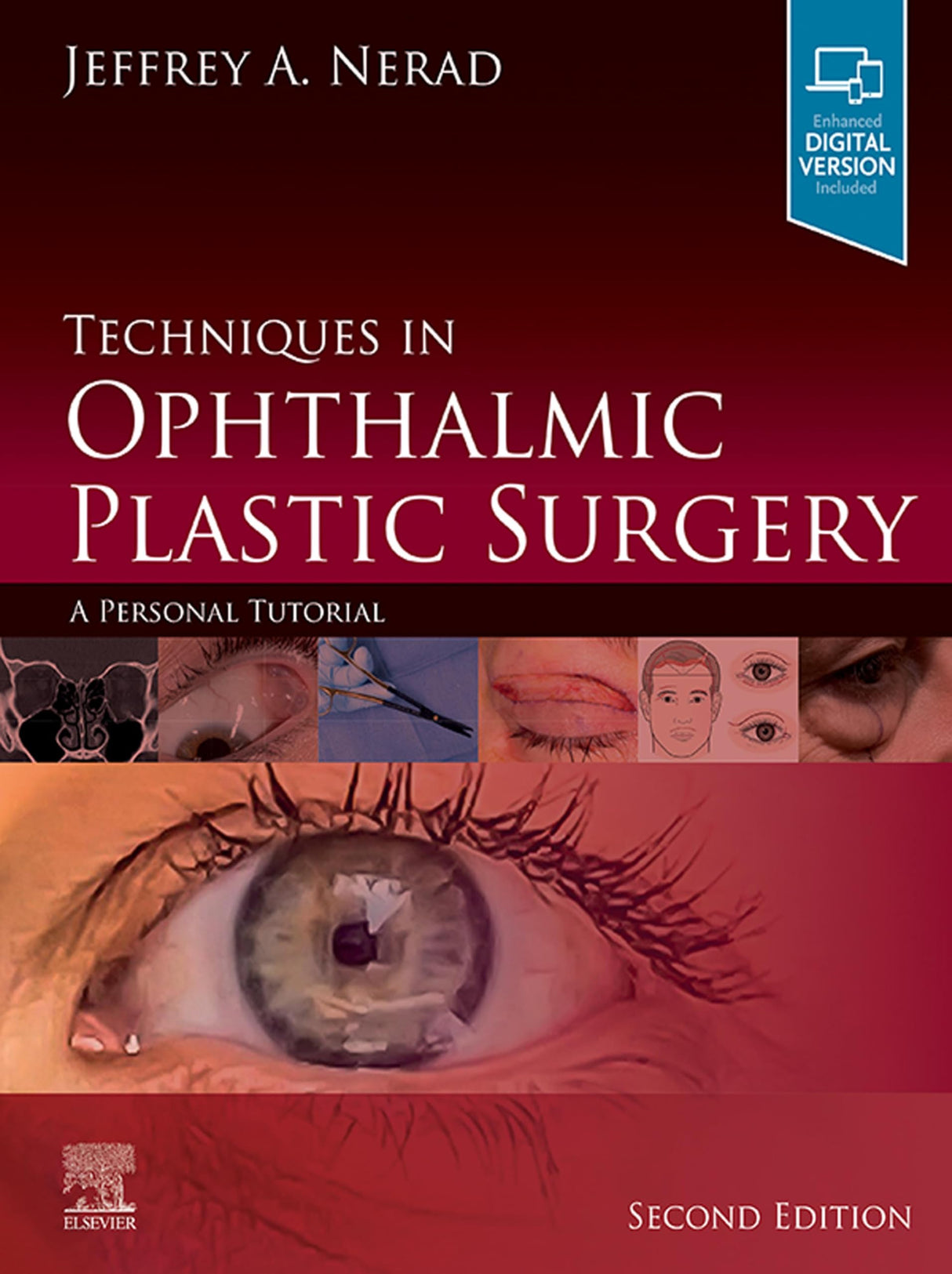 Techniques in Ophthalmic Plastic Surgery E-Book: A Personal Tutorial