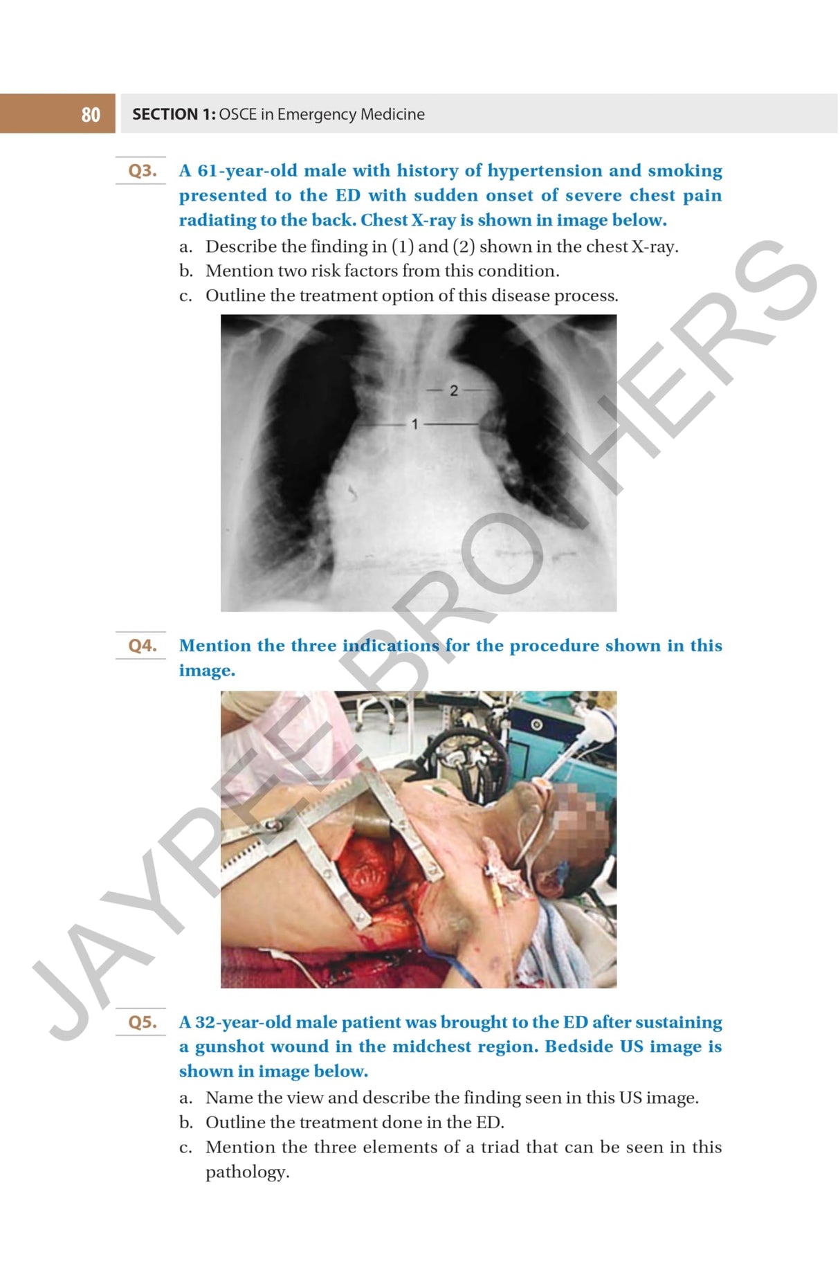 OSCE FOR EMERGENCY MEDICINE PRACTICAL EXAM