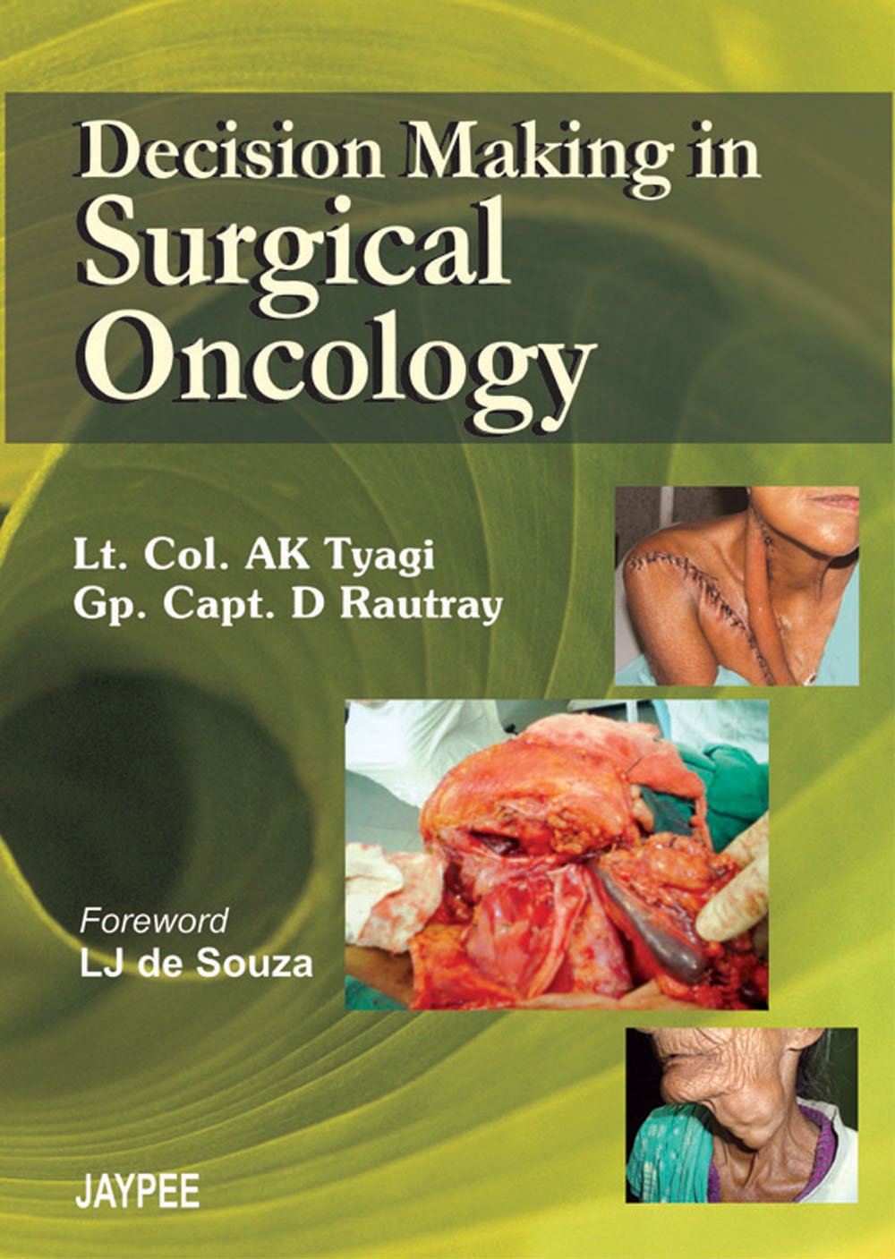 DECISION MAKING IN SURGICAL ONCOLOGY