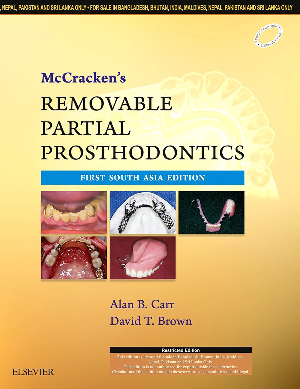 MCCRACKEN'S REMOVABLE PARTIAL PROSTHODONTICS