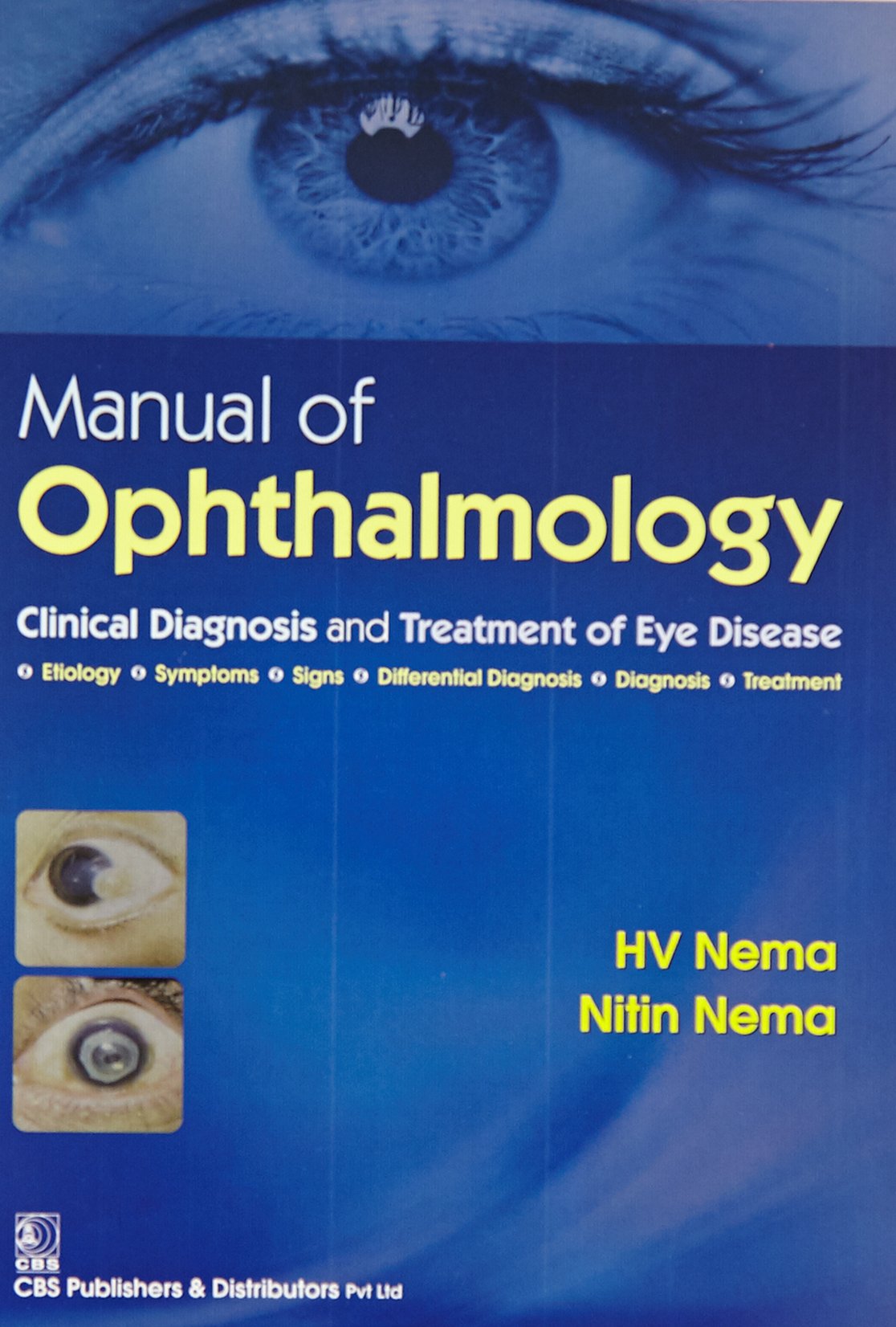 Manual Of Opthalmology Clinical Diagnosis And Treatment Of Eye Disease (Pb 2016)