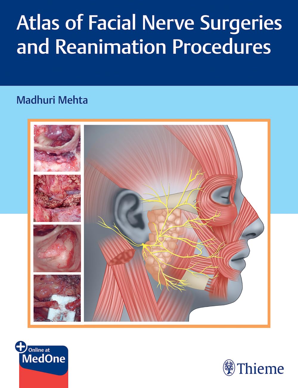 Atlas of Facial Nerve Surgeries and Reanimation Procedures - Retail Maharaj