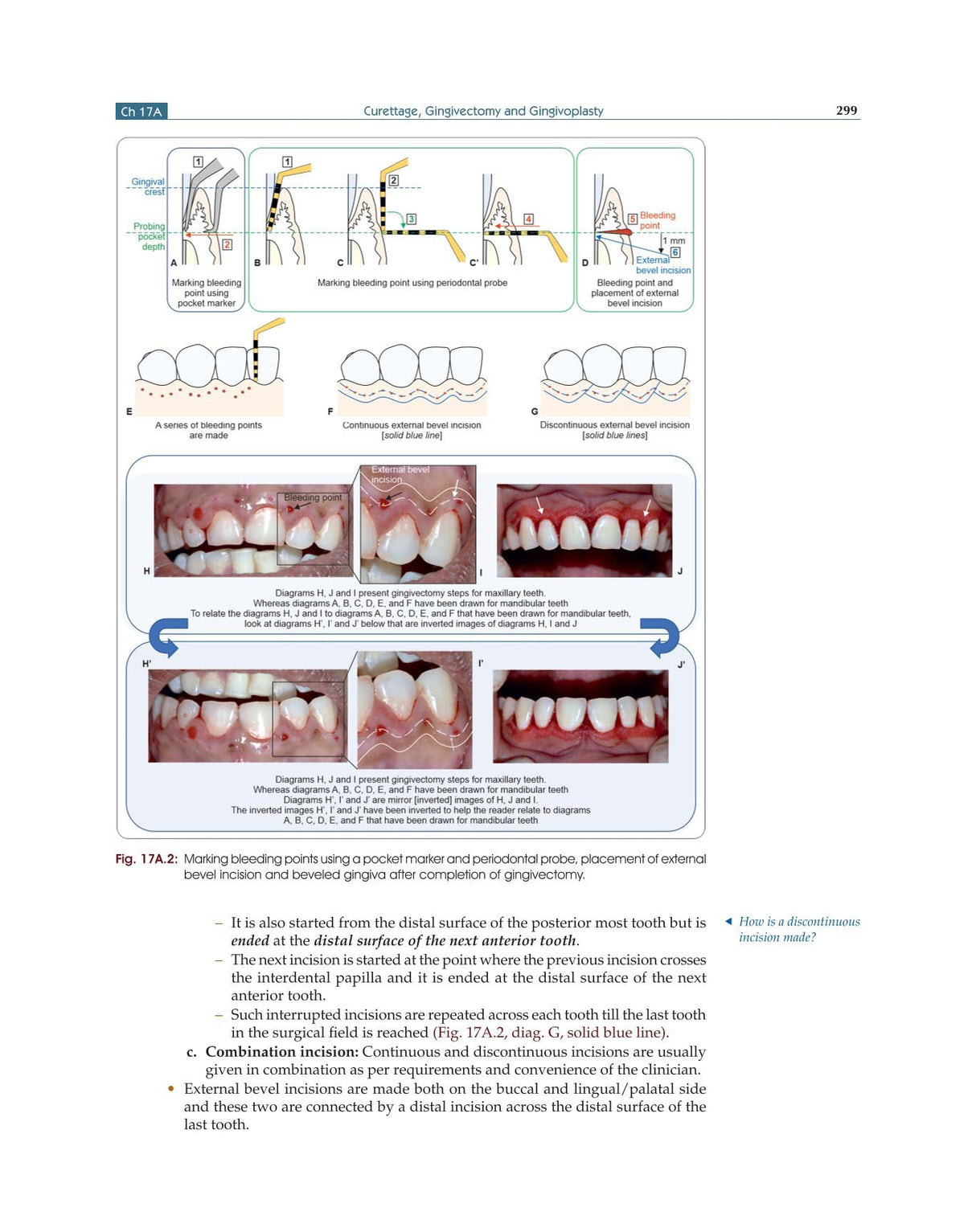 Textbook of Periodontology for Undergraduate Students - 2024