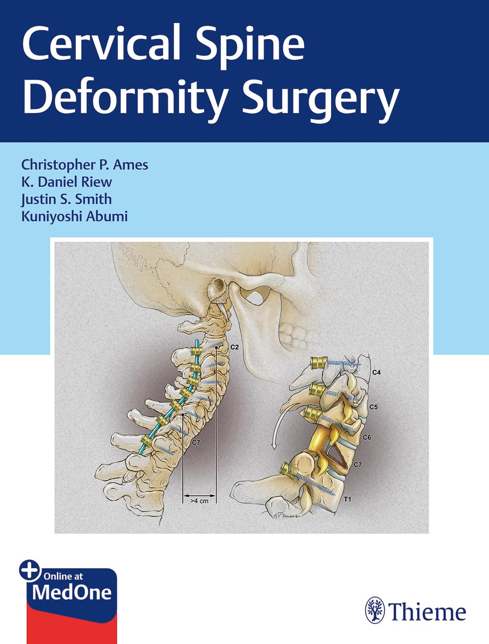 Cervical Spine Deformity Surgery - Retail Maharaj