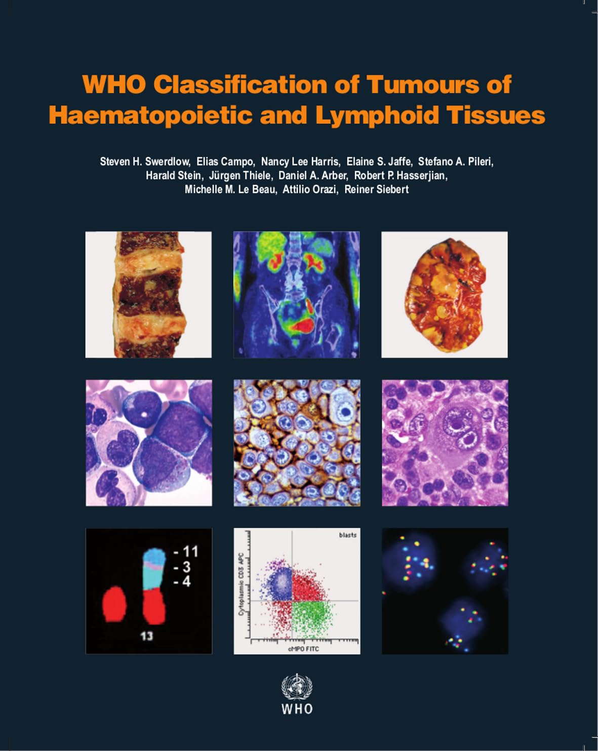 WHO classification of tumours of haematopoietic and lymphoid tissues: Vol. 2 - Retail Maharaj