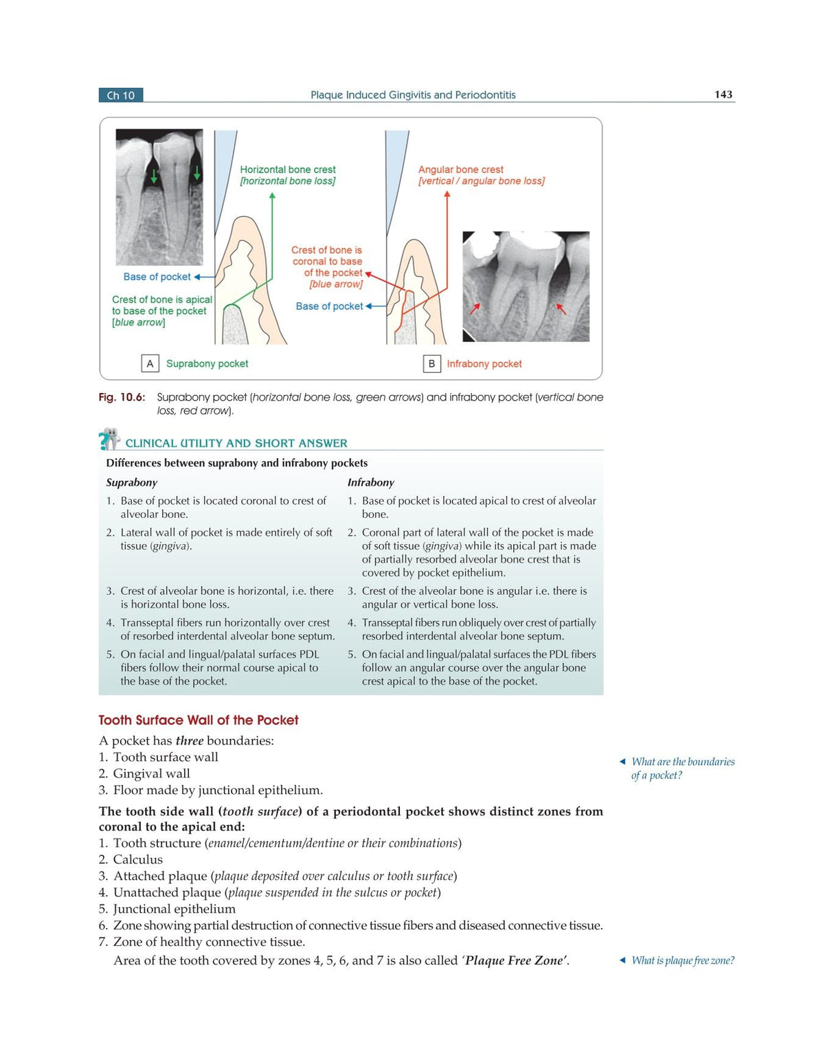 Textbook of Periodontology for Undergraduate Students - 2024