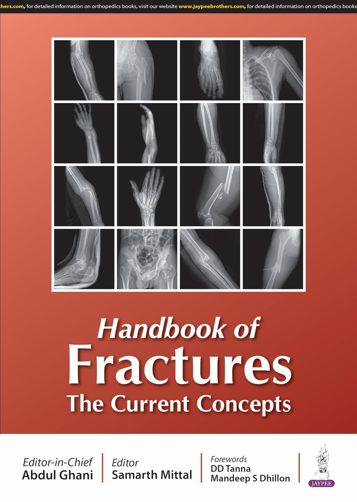 HANDBOOK OF FRACTURES THE CURRENT CONCEPTS - Retail Maharaj