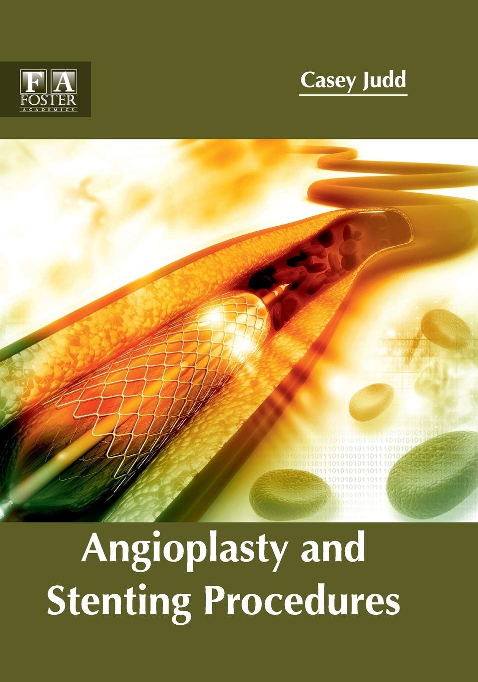 Angioplasty and Stenting Procedures - Retail Maharaj