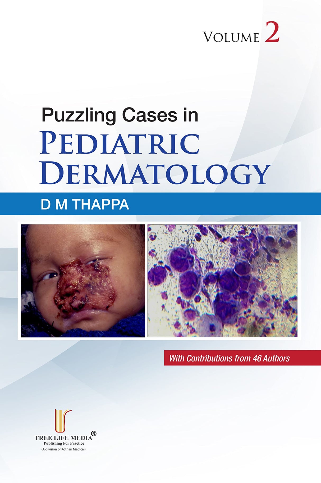 Puzzling Cases in Pediatric Dermatology - Volume 2