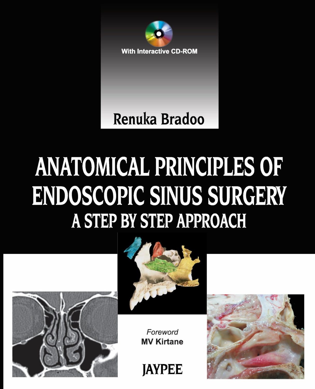 ANATOMICAL PRINCIPLES OF ENDOSCOPIC SINUS SURGERY: A STEP BY STEP APPROACH WITH INTERACTIVE CD-ROM