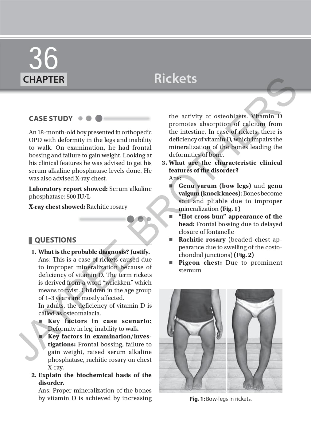 EARLY CLINICAL EXPOSURE: A CASE BASED APPROACH IN CLINICAL BIOCHEMISTRY