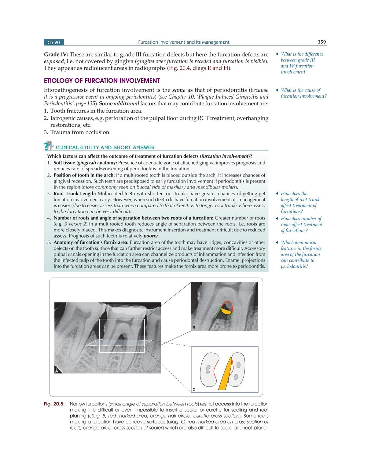 Textbook of Periodontology for Undergraduate Students - 2024