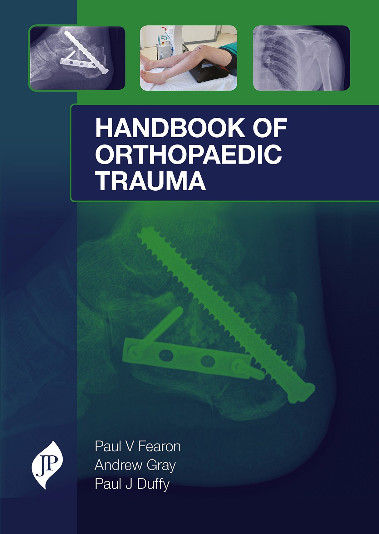 HANDBOOK OF ORTHOPAEDIC TRAUMA SURGICAL MANAGEMENT FROM ADMISSION TO REHABILITATION