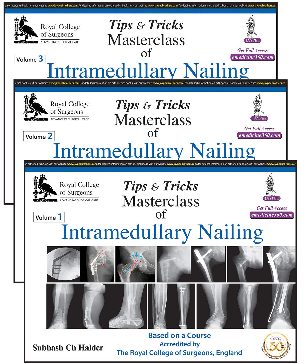 Tips and Tricks Masterclass of Intramedullary Nailing