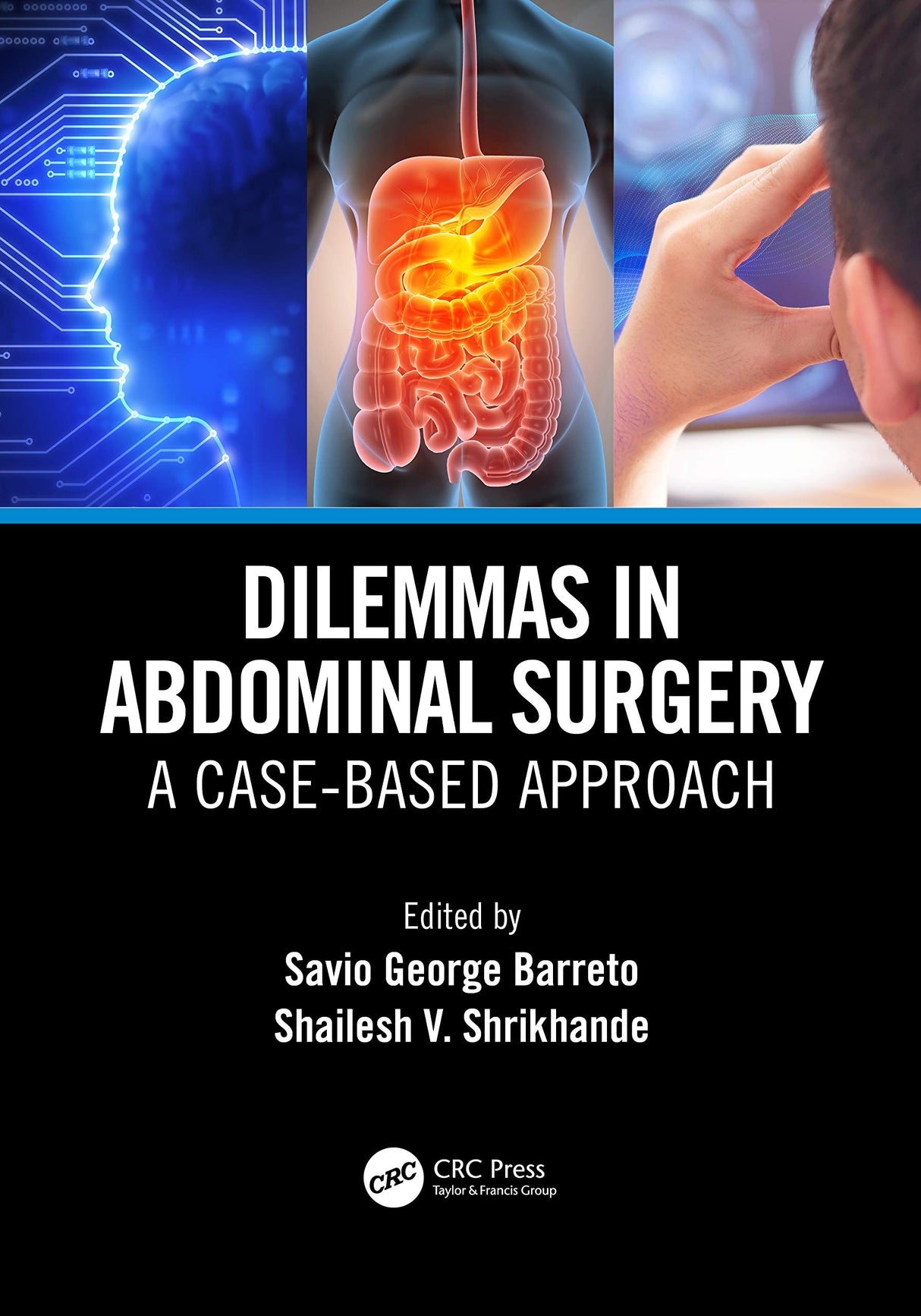 Dilemmas In Abdominal Surgery A Case Based Approach (Pb 2021)
