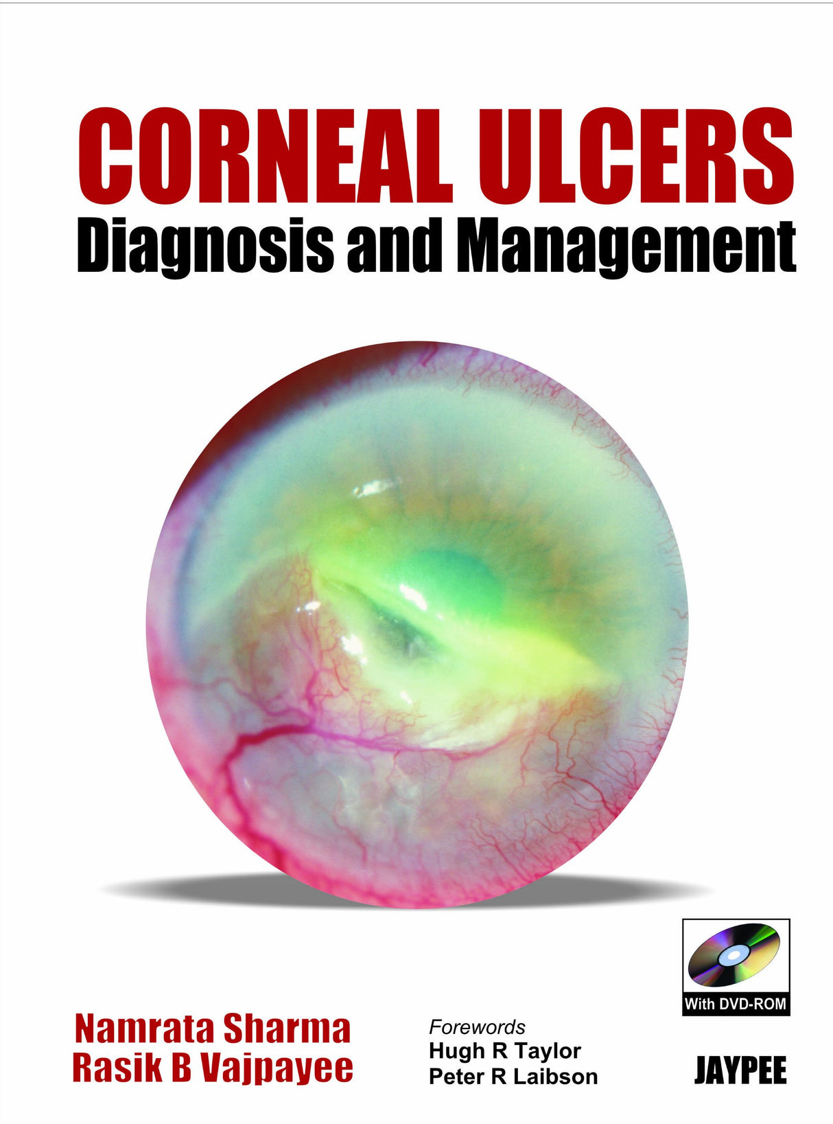 Corneal Ulcer Diagnosis and Management with DVD-ROM