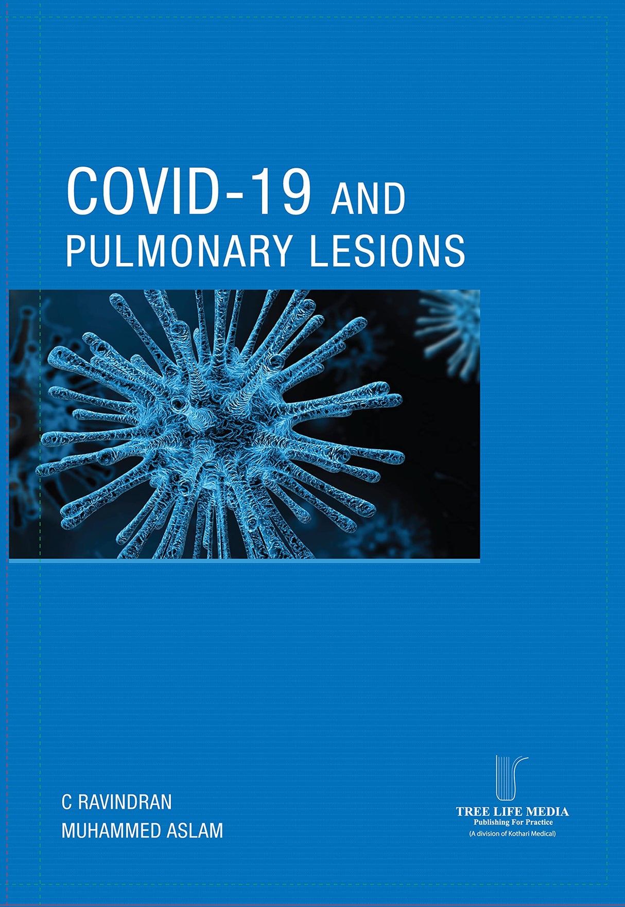 COVID - 19 AND PULMONARY LESIONS