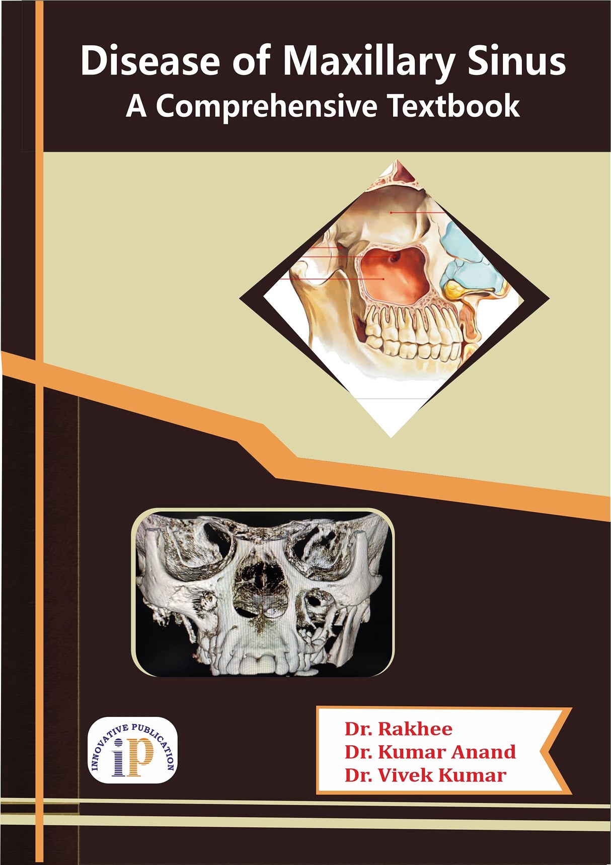Disease of Maxillary Sinus - A Comprehensive Textbook - Retail Maharaj