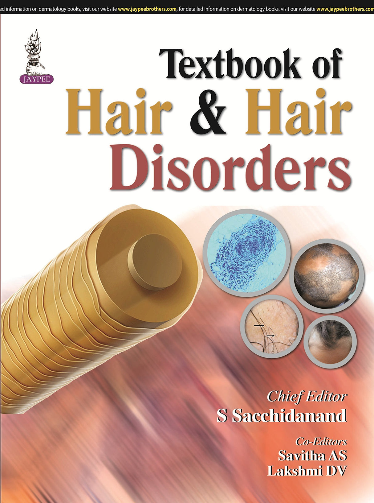 HAIR AND HAIR DISORDERS: DIAGNOSIS & MANAGEMENT