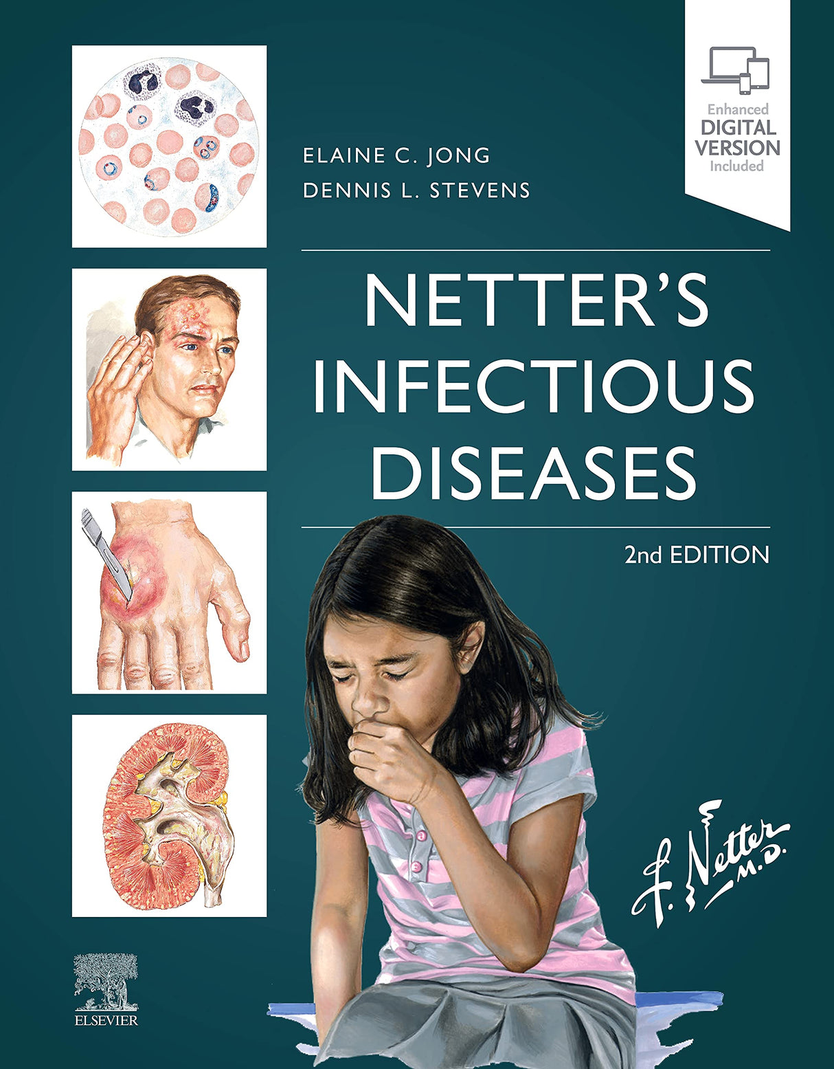 Netter's Infectious Diseases, 2e