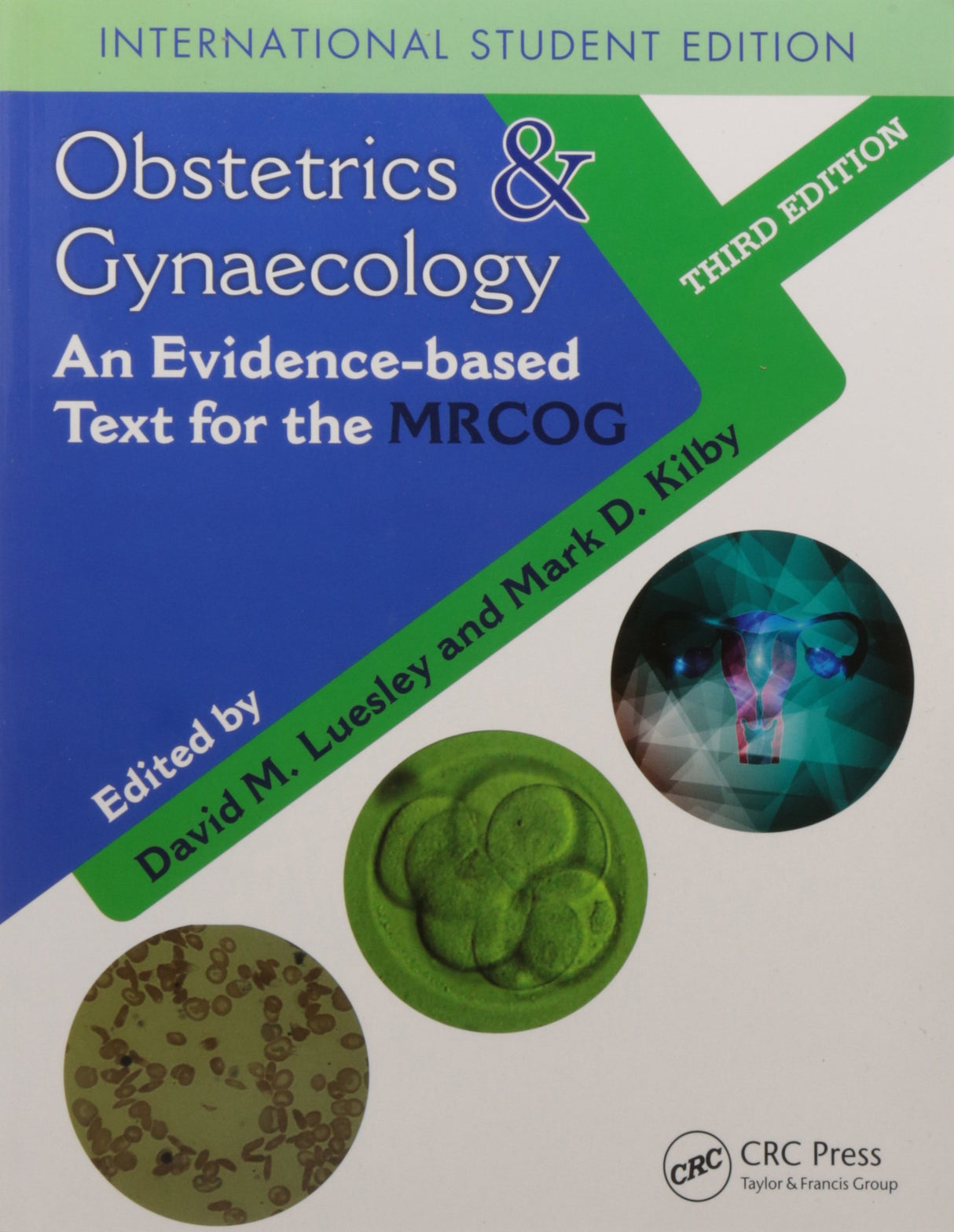 OBSTETRICS AND GYNAECOLOGY: AN EVIDENCE-BASED TEXT FOR MRCOG