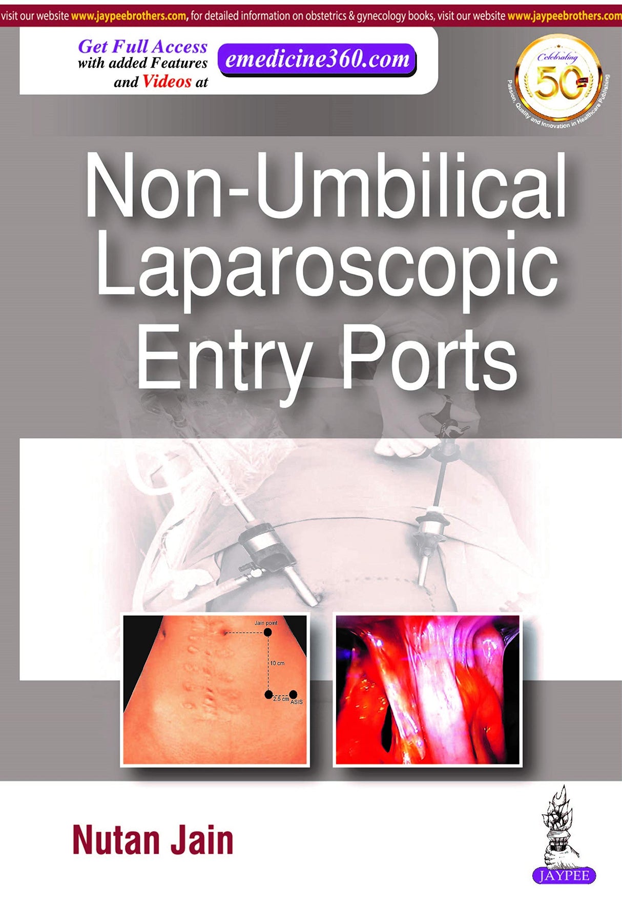 NON-UMBILICAL LAPAROSCOPIC ENTRY PORTS