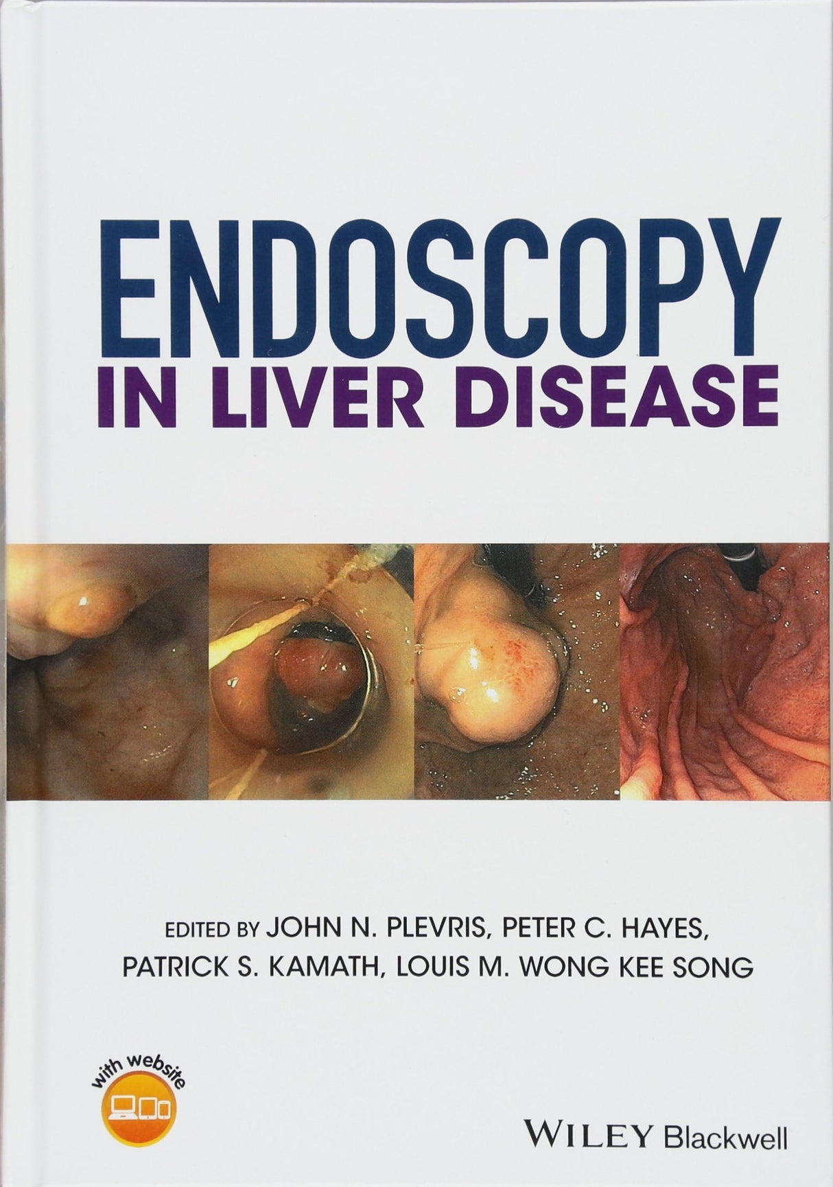 Endoscopy In Liver Disease (Hb 2018)