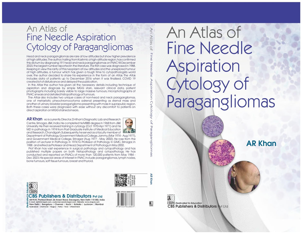 An Atlas of Fine Needle Aspiration Cytology of Paragangliomas