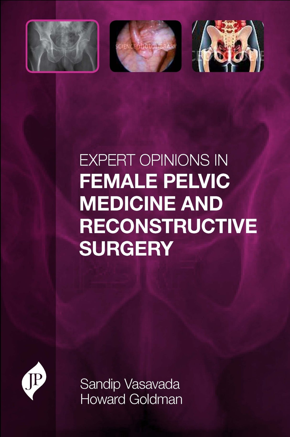 Expert Opinions in Female Pelvic Medicine and Reconstructive Surgery