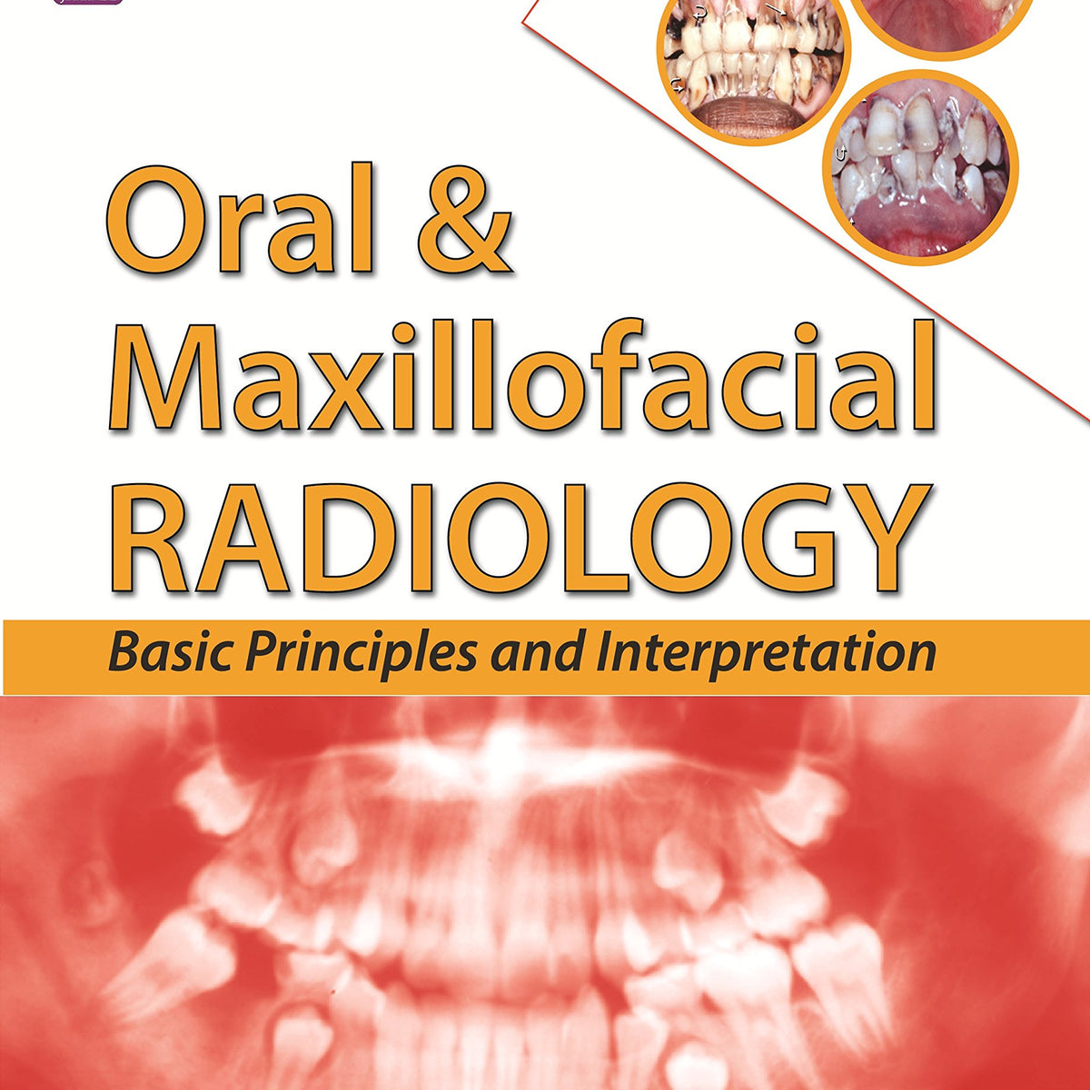 ORAL & MAXILLOFACIAL RADIOLOGY BASIC PRINCIPLES AND INTERPRETATION