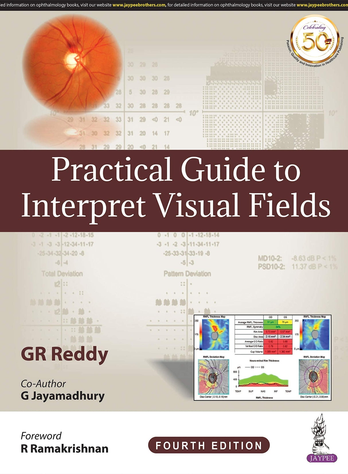 PRACTICAL GUIDE TO INTERPRET VISUAL FIELDS