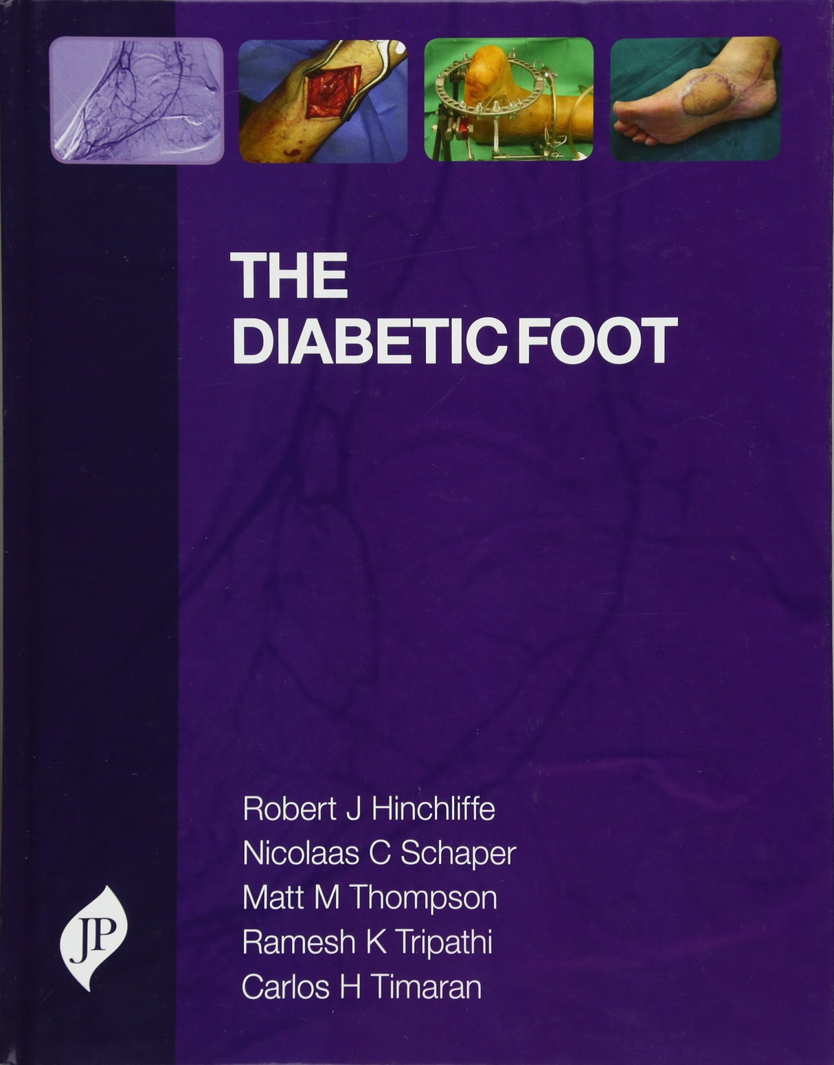 THE DIABETIC FOOT