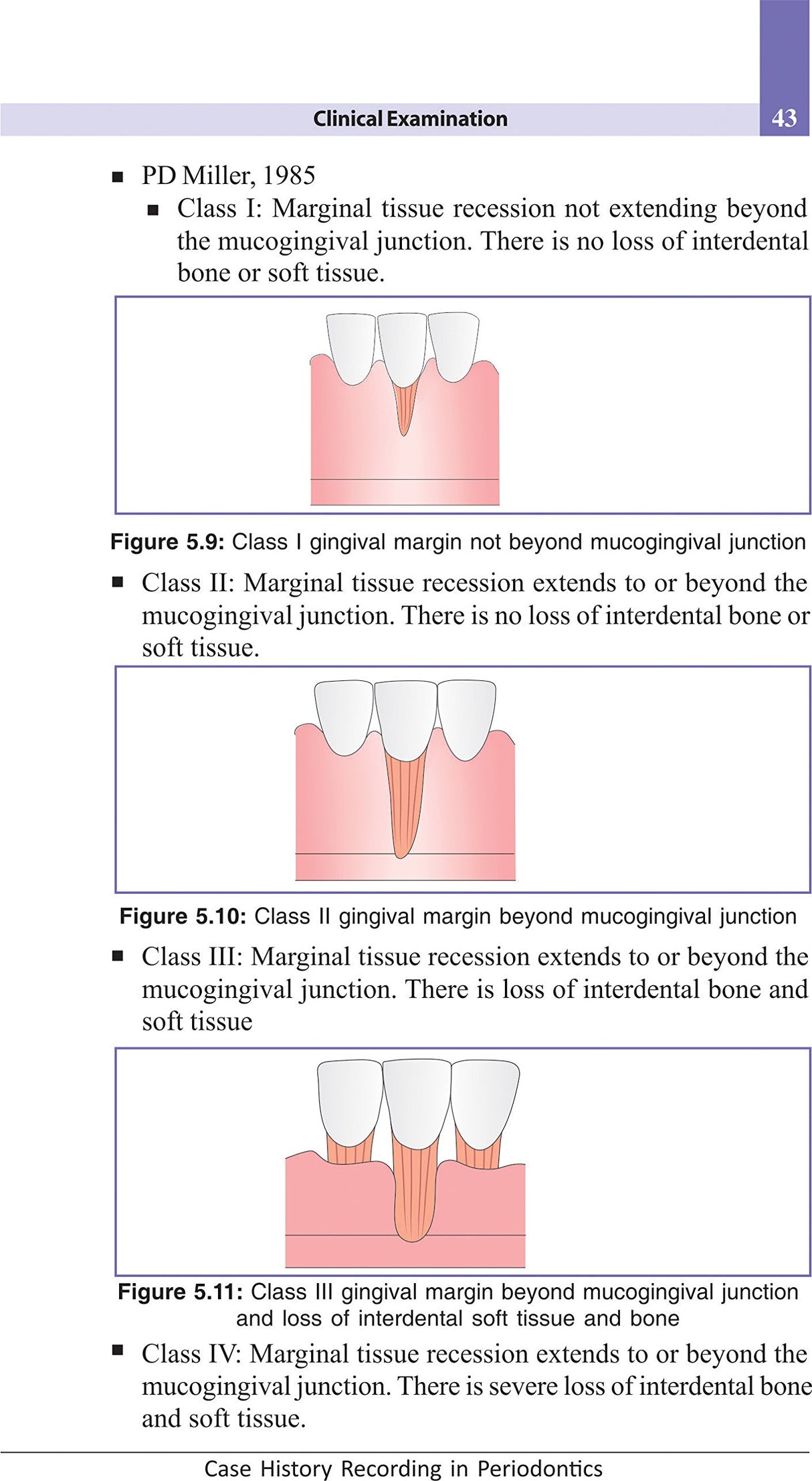 Case History Recording In Periodontology, Divya Bhat - 2nd, 2017.0