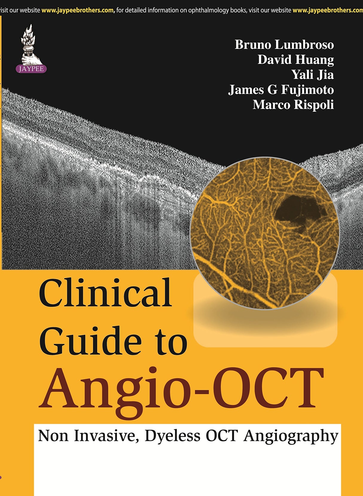 CLINICAL GUIDE TO ANGIO-OCT: NON INVASIVE,DYELESS OCT ANGIOGRAPHY
