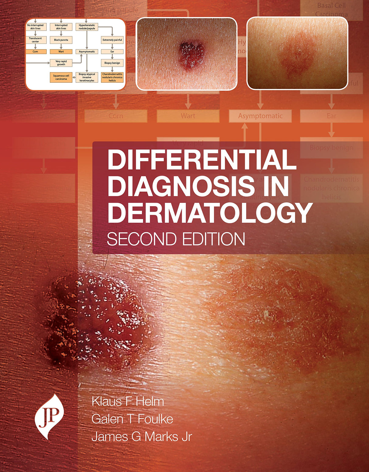 DIFFERENTIAL DIAGNOSIS IN DERMATOLOGY