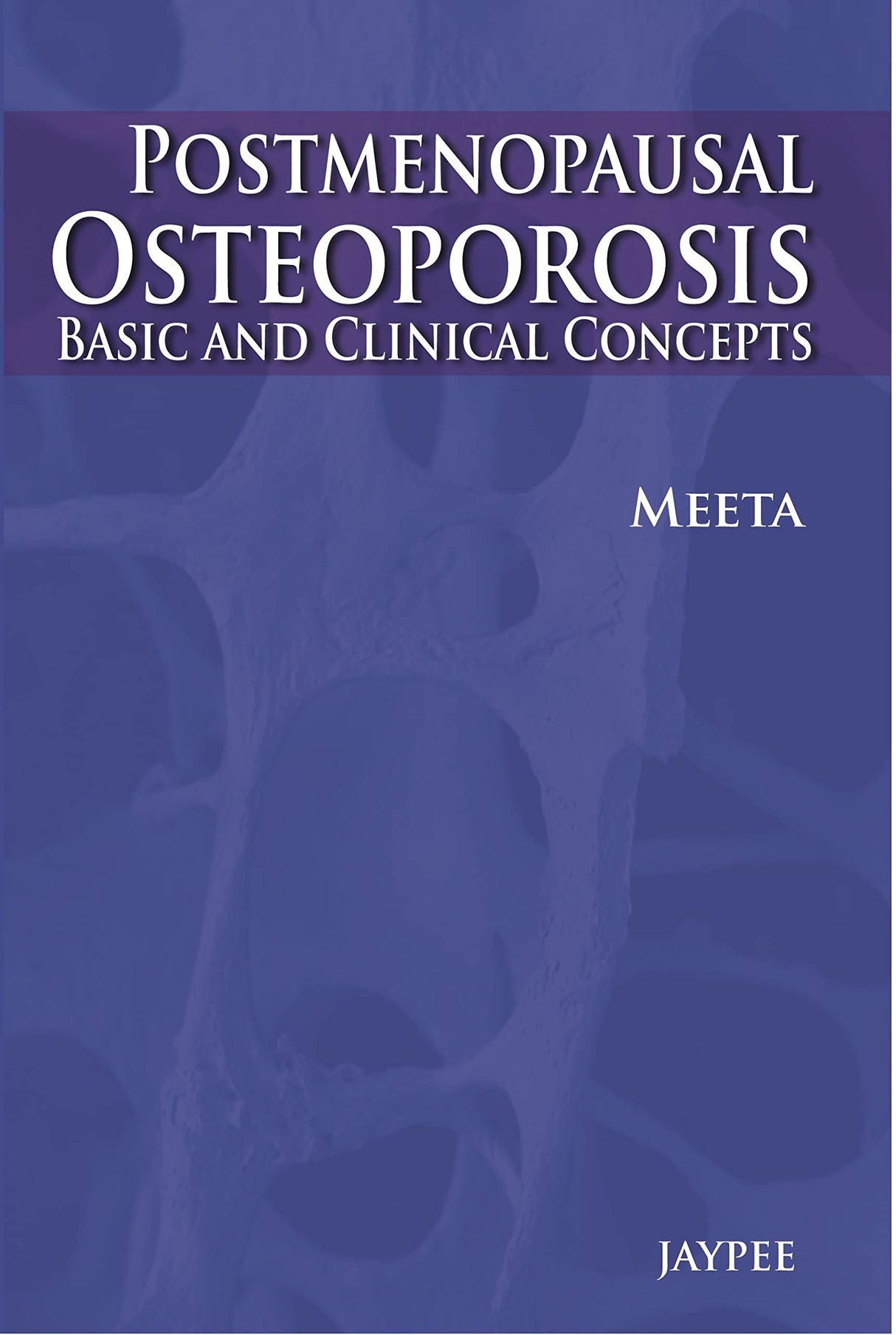 POSTMENOPAUSAL OSTEOPOROSIS BASIC & CLINICAL CONCEPTS