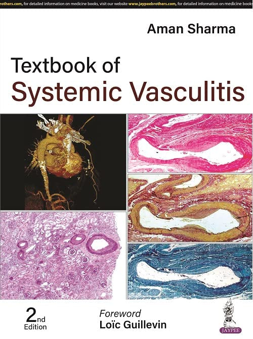 Textbook of Systemic Vasculitis - Retail Maharaj