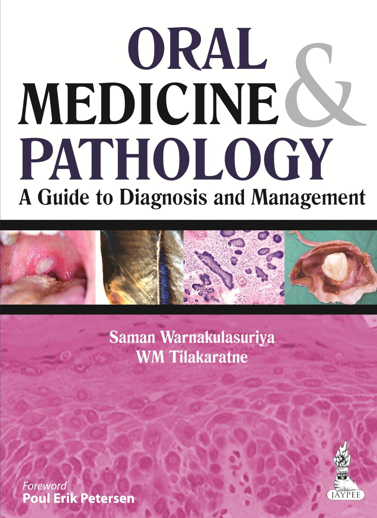 ORAL MEDICINE & PATHOLOGY A GUIDE TO DIAGNOSIS AND MANAGEMENT