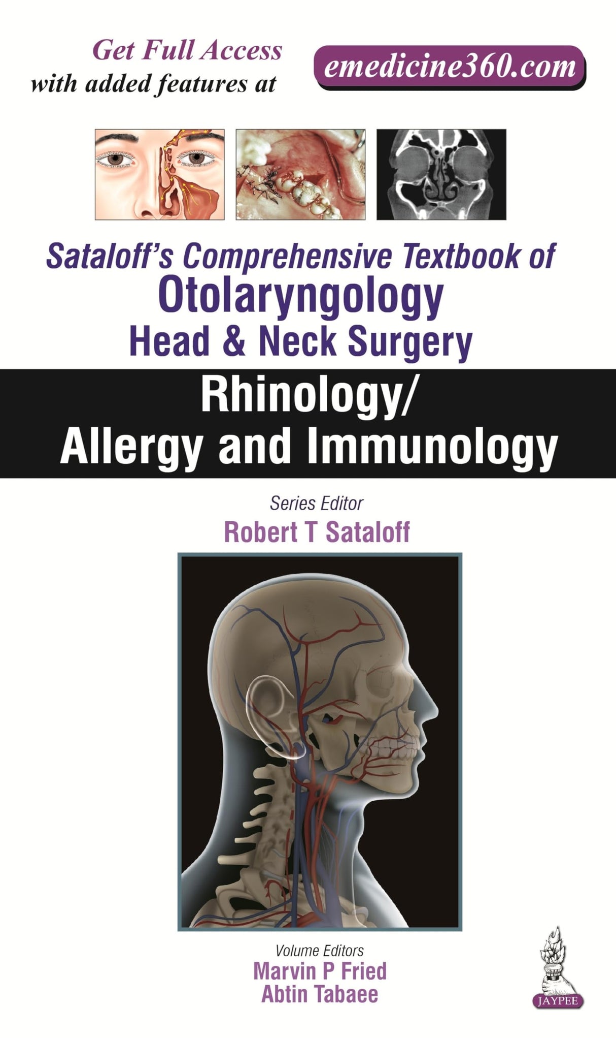 SATALOFF'S COMPREHENSIVE.TB.OF OTOLARY. HEAD&NECK SURGERY RHINOLOGY/ALLERY AND IMMUNOLOGY VOL.2
