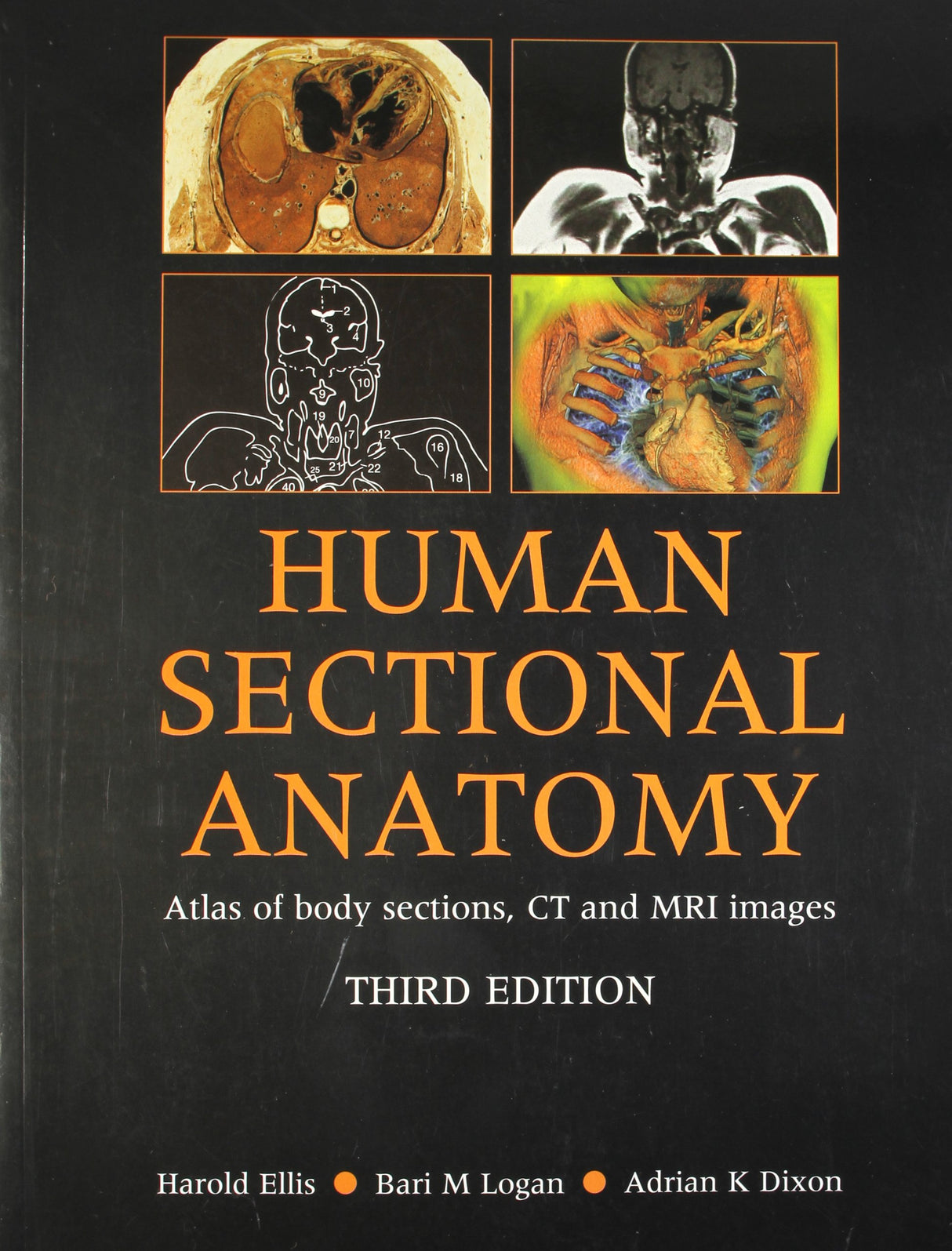 (OLD)HUMAN SECTIONAL ANATOMY ATLAS OF BODY SECTIONS, CT AND MRI IMAGES