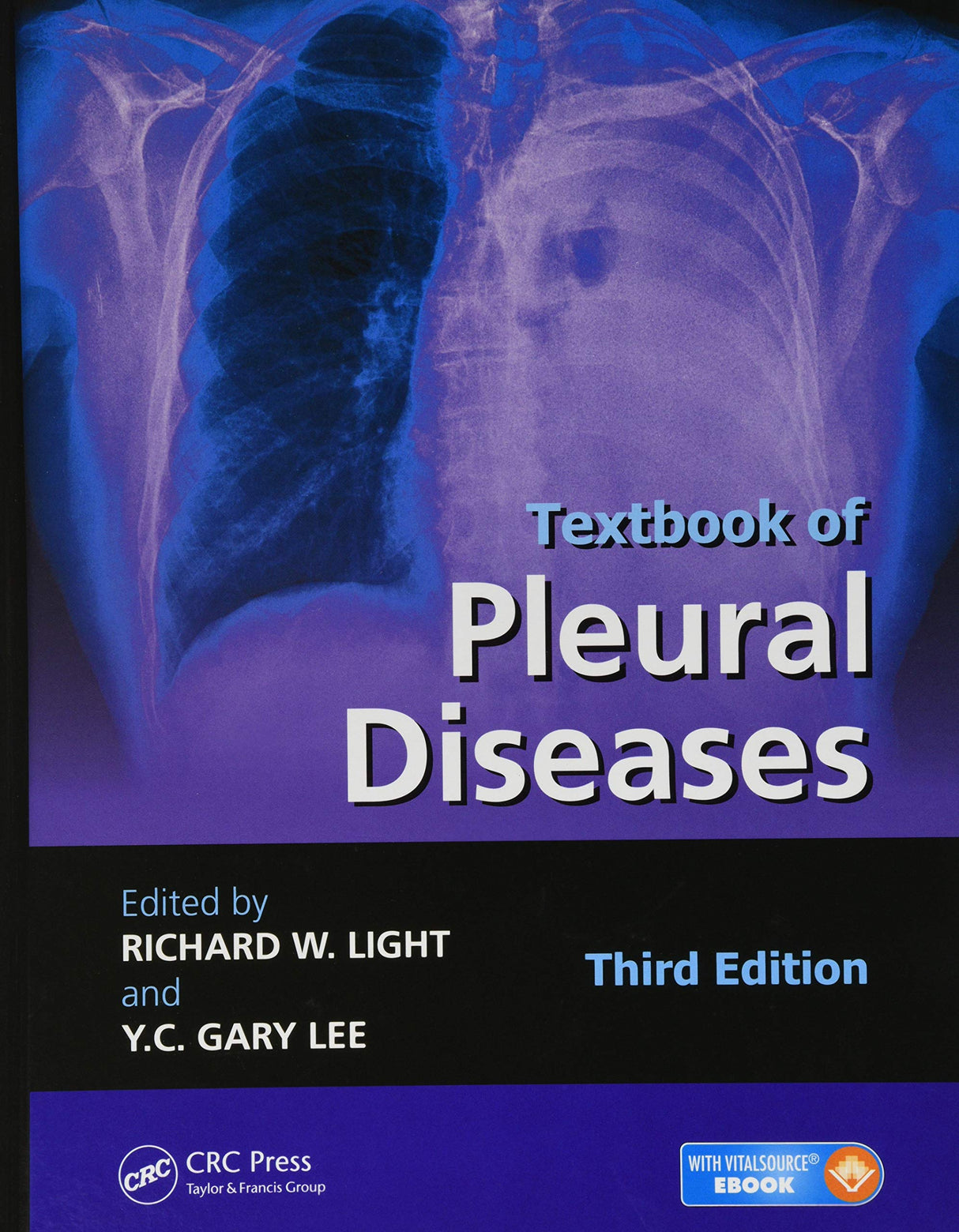 Textbook of Pleural Diseases